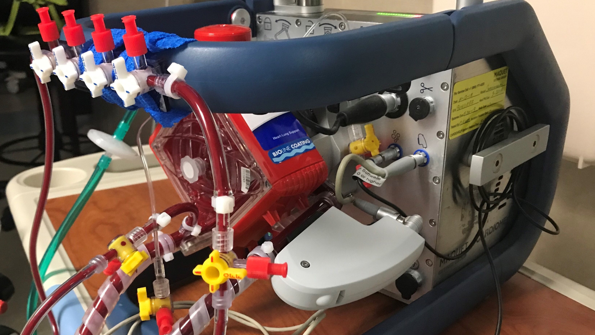 The ECMO Program of Carolinas Medical Center and Levine Children’s Hospital received their fourth consecutive ELSO Award for Excellence in 2020. The ELSO Excellence Award honors programs who reach the highest level of performance, innovation, and quality in the specialty of extracorporeal support.