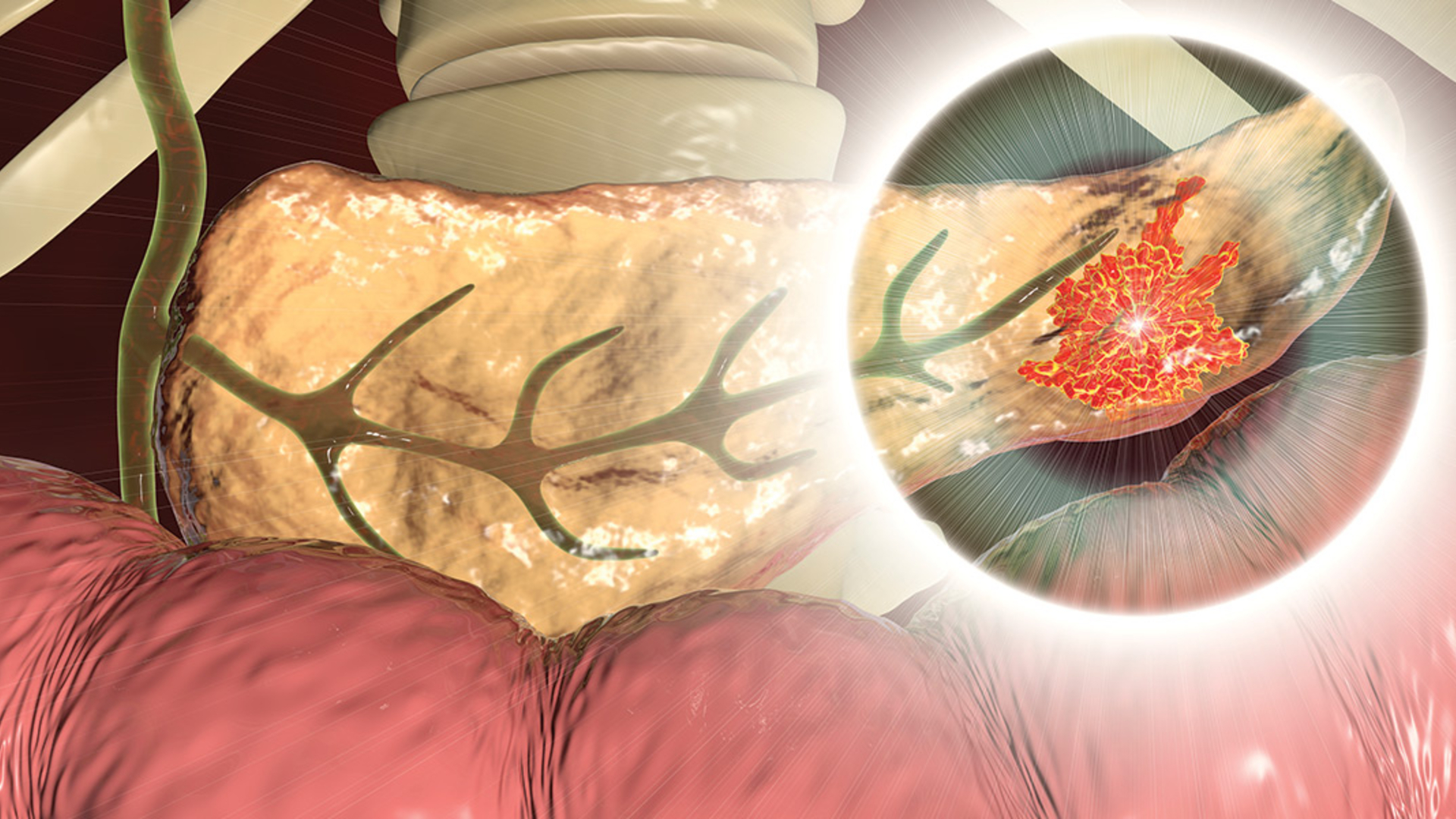 Atrium Health is home to six fellowship-trained HPB surgeons who perform more than 120 pancreaticoduodenectomies per year. As one of the pioneers of RPD, the team has been conducting the procedure for almost a decade, and have performed over 1,000 robotic HPB procedures overall.