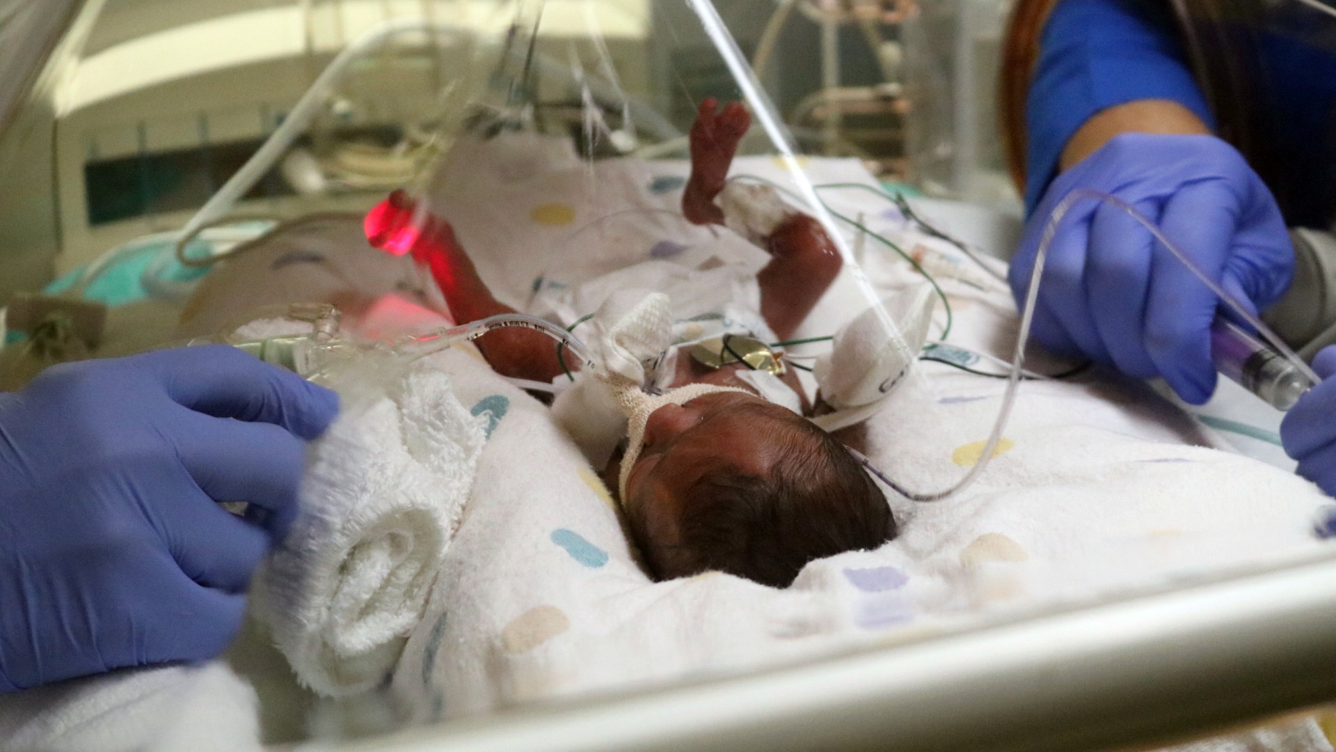 Daily Dose Levine Children S Nicu Cares For Tiniest Evacuees