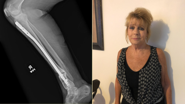 Cathy Hixon_featured_thumb