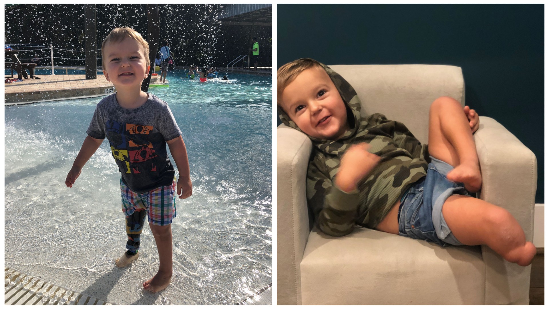 Keekly was born with a rare birth defect, and his parents were told he may never walk. With the help of an award-winning orthopedic surgery program, he’s not just walking into preschool – he’s running.