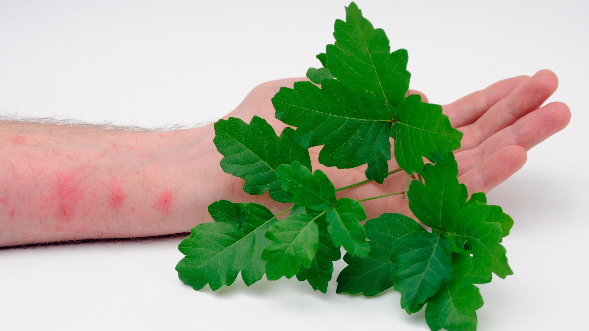 Daily Dose - You Asked, We Answered - 6 Things to Know about Poison Ivy and Oak Daily Dose - You Asked, We Answered - 6 Things to Know about Poison Ivy and Oak